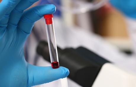 L’inhibition d'un gène récepteur olfactif pourrait réduire considérablement la métastase des cellules cancéreuses du sein (Visuel Adobe Stock 305239900) L’inhibition d'un gène récepteur olfactif pourrait réduire considérablement la métastase des cellules cancéreuses du sein (Visuel Adobe Stock 305239900)