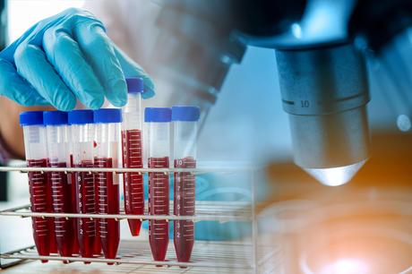 Cette recherche israélienne est plutôt, à ce stade de la pandémie et d'émergence de variants à forte capacité d'échappement, en faveur d’une immunité naturelle plutôt que vaccinale (Visuel Adobe Stock 283646387) Cette recherche israélienne est plutôt, à ce stade de la pandémie et d'émergence de variants à forte capacité d'échappement, en faveur d’une immunité naturelle plutôt que vaccinale (Visuel Adobe Stock 283646387)