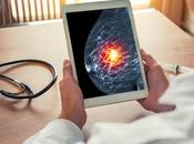 CARCINOME CANALAIRE SITU Mieux conseiller, mieux dissiper l’anxiété