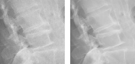 Application de la NR intelligente