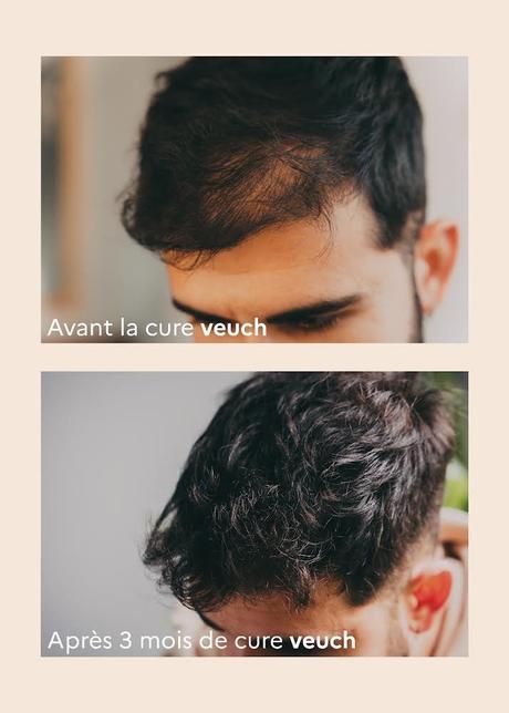 Veuch, des produits sur-mesure pour mettre fin aux chutes de cheveux