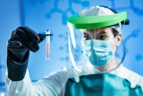 On continue d'apprendre sur le virus SARS-CoV-2 et ici, sur les gènes viraux qui peuvent rendre certains de ses variants plus virulents (Visuel Adobe Stock 210512835) On continue d'apprendre sur le virus SARS-CoV-2 et ici, sur les gènes viraux qui peuvent rendre certains de ses variants plus virulents (Visuel Adobe Stock 210512835)