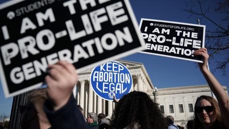 De quoi l'avortement est-il le nom ? Une réflexion sur le droit à la vie.