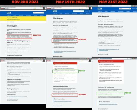 Variole du singe : à quoi peut-on s’attendre ?
