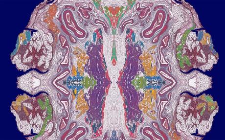 Représentation du système gastro-intestinal (Illustration Zahra Aghababaie, University of Auckland) Représentation du système gastro-intestinal (Illustration Zahra Aghababaie, University of Auckland)