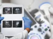 CALCULS BILIAIRES L’annonce d’un cancer pancréas