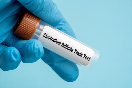 La responsabilité de la bactérie Clostridioides difficile (C. difficile) est documentée dans le développement de certains cancers colorectaux (Visuel Adobe Stock 502698057)