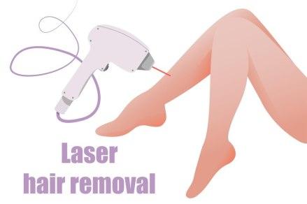 Epilation Femme : Pourquoi passer à la l’épilation laser ?