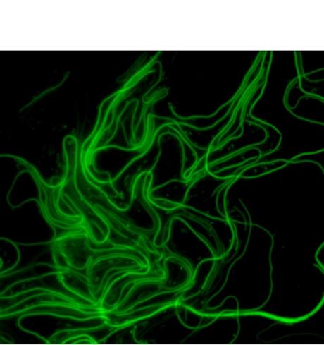 Les bactéries sous forme de filaments, donc pendant cette phase de métamorphose, n’obéissent pas aux règles normales de la division cellulaire (Visuel Australian Institute for Microbiology and Infection, University of Technology Sydney)