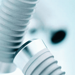 Intérêt des implants de large diamètre