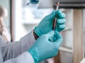 HYPERTENSION ARTÉRIELLE PULMONAIRE test sanguin pour évaluer sévérité