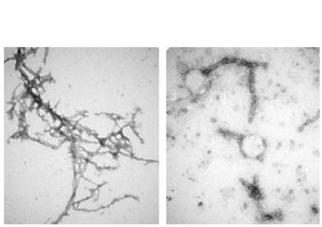 PFFNB2 parvient à gommer les amas d'alpha-synucléine tout en épargnant les molécules monomères d'alpha-synucléine qui ne sont pas nocives (Visuel Xiaobo Mao)