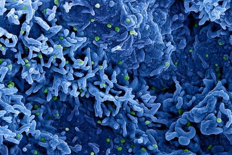 L'essai sera mené auprès de plus de 500 participants, dont des femmes enceintes et des enfants (Visuel NIAID) L'essai sera mené auprès de plus de 500 participants, dont des femmes enceintes et des enfants (Visuel NIAID)