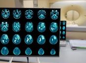 GLIOME nouveau médicament cible faille tumeur