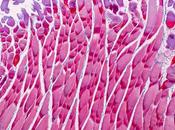 MYOPATHIE DUCHENNE Corriger cellules tout début processus