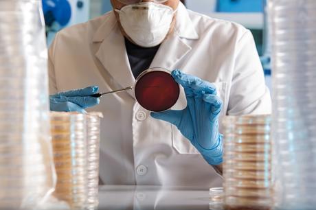 Restaurer les parois de l'intestin à l'aide de cellules souches épithéliales pourrait aider à prévenir les troubles cognitifs après l’AVC (Visuel Adobe Stock 280430718) Restaurer les parois de l'intestin à l'aide de cellules souches épithéliales pourrait aider à prévenir les troubles cognitifs après l’AVC (Visuel Adobe Stock 280430718)