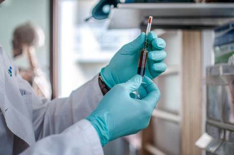 Les niveaux sanguins d'ADN Les niveaux sanguins d'ADN