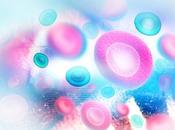 ZONA Comment peut déclencher l’AVC