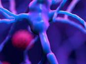 SCLÉROSE PLAQUES CAR-T anti-MOG