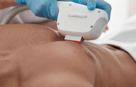 Epilation masculine : dites non aux poils superflus !