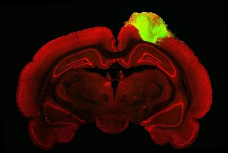 Des neurones humains implantés dans le cerveau d'un rat réagissent à des lumières clignotantes