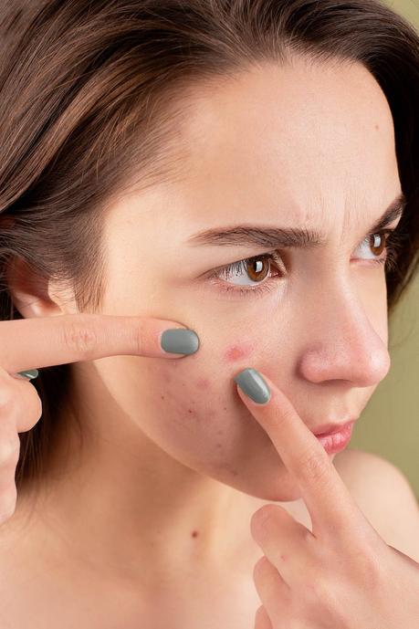 Pin Up Secret : des soins de la peau naturels et efficaces