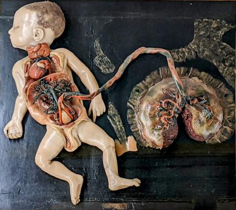 Les cires anatomiques de la collection Luigi Cattaneo à Bologne —  20 photographies
