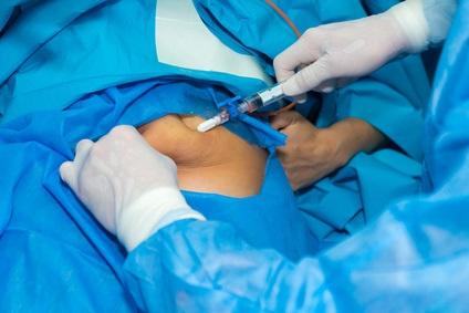 Le remodelage corporel favorise-t-il la perte de poids à long terme après une chirurgie bariatrique ? (Visuel Fotolia 178236449) Le remodelage corporel favorise-t-il la perte de poids à long terme après une chirurgie bariatrique ? (Visuel Fotolia 178236449)