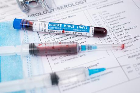 Le virus Langya, un virus hautement infectieux, qui vient tout juste de se transmettre des animaux aux humains est capable de pénétrer dans les cellules humaines (Visuel Adobe Stock 332932375) Le virus Langya, un virus hautement infectieux, qui vient tout juste de se transmettre des animaux aux humains est capable de pénétrer dans les cellules humaines (Visuel Adobe Stock 332932375)