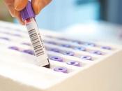 MALADIE VIVO test sanguin pour diagnostiquer