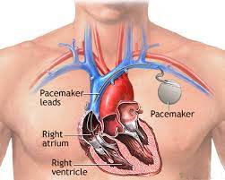 Jouer au détective médical