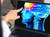 DÉPRESSION caractéristiques uniques après trauma cérébral