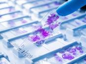 CARCINOME CELLULES MERKEL d’école pour comprendre réplication virale