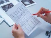 FIBRILLATION AURICULAIRE documenter l’ECG avant toute prescription d’anticoagulants